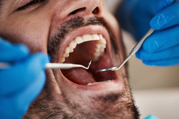 Best Emergency Treatment for Jaw Pain or Injury in Long Beach, MD